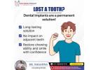 Nagu Dental Speciality | Dental Clinic In RR Nagar Bangalore