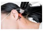 Envy Aesthetics Offer Laser Tattoo Removal With Precision And Care