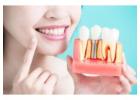 Emergency Dental Care in Alpharetta