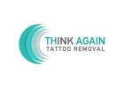 Think Again Tattoo Removal - Los Angeles