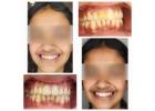 Dr. Bhutani Dental Clinic stands as the best dentist in Delhi NCR