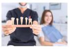 Can Braces Melbourne Help You Smile with Confidence Again?