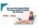 How Laser Hair Removal Works – The Science Behind Permanent Hair Reduction
