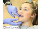 Tooth Extraction in Overland Park