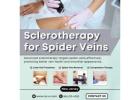 Sclerotherapy for Spider Veins NJ