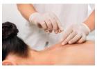 Trigger Point Dry Needling Therapy - Grand Madison Acupuncture