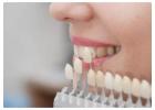 Where To Find Porcelain Veneers Melbourne For Natural Dental Results?