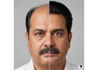 Men’s Hair Wig Shop in Delhi – Raj Hair Wig