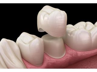 Dental Clinic in Kukatpally | Best Dental Hospital in KPHB |  Viha Dento Care Dental Clinic in Kukatpally | Best Dental Hospital in KPHB |  Viha Dento Care