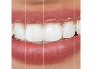 Dental Clinic in Vijayawada | Best Dental Hospital in Vijayawada | Dentists in Vijayawada -  Andhra Dental Clinic in Vijayawada | Best Dental Hospital in Vijayawada | Dentists in Vijayawada -  Andhra