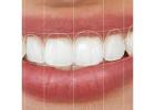 Dental Clinic in Vijayawada | Best Dental Hospital in Vijayawada | Dentists in Vijayawada -  Andhra
