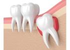 Dental Clinic in kukatpally | Best Dental Hospital in kukatpally | - Aksha Dental