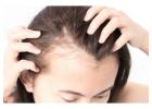 Best Hair Regrowth Treatment for Thinning and Hair Loss