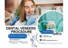 Is Dental Veneers Procedure Painful ?