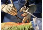 Minimally Invasive Spine Surgery in Kerala | Faster Recovery & Precision