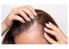 Female Hair Loss Treatment