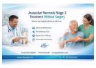 Avascular Necrosis Stage 2 Treatment Without Surgery – HipXpert