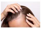 Discover Expert Hair Loss Solutions at Zoya Salon & Extensions in Dallas