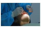 Reliable St Louis Urgent Dental Care Solutions for Fast Pain Relief and Same Day Treatment
