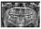 Revive your natural and flawless smiles with holistic Dental care in Tijuana