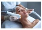 Laser Hair Removal Treatment