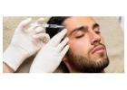 Botox Treatment for Face