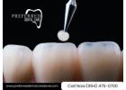 Restore Your Smile with Expert Dental Restoration Near Me!