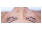 Laser treatment for face pigmentation