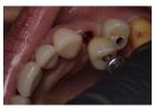Dentist in Tijuana