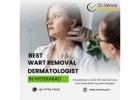 Best Wart Removal Dermatologist In Hyderabad | Dr. Venus