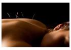 Pain Management Acupuncture in NYC | Back, Neck & Sciatica Relief