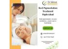 Best Pigmentation Treatment Hyderabad | Dr. Venus