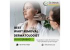 Wart Removal Clinic In Hyderabad | Dr. Venus