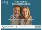 Full Mouth Rehabilitation | Restore Your Smile & Oral Health