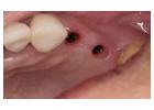 Biological Dentist in Tijuana, Mexico – Safe, Natural Dental Care
