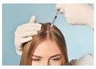 Exosomes for Hair Loss in Islamabad