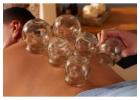 Gliding Cupping Massage In Philadelphia | Detox & Reduce Muscle Stiffness