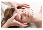 Acupuncture Treatment Thornhill: Awakens Inner Healing Energy at Midori Day Spa