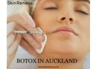 Ready to Smooth Fine Lines? Discover Botox Hibiscus Coast in Whangaparaoa!