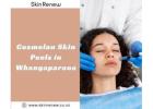 Cosmelan Treatment in Whangaparaoa – Clearer, Brighter Skin with Skin Renew