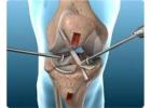 Best Orthopedic Surgeon in Indore for Joint & Spine Care – Dr. Sanjay Rawat
