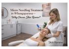 Micro Needling Treatment for Smooth, Glowing Skin | Skin Renew
