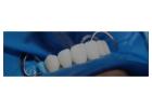 Find Trustworthy Teeth Replacements with Tijuana Dental Implants