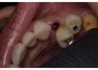 Holistic Dentist in Mexico – Natural, Biocompatible Care for Your Health and Smile