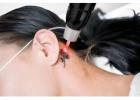 Envy Aesthetics Offer Laser Tattoo Removal With Precision And Care