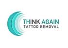 Think Again Tattoo Removal - Los Angeles