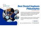 Affordable Dental Implants Philadelphia Offering Lasting Smile Solutions at My Smile For Life