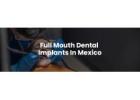 Full Mouth Dental Implants in Mexico with Teeth Savers