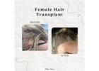 Dr Ditta Hair Transplants- Expert Hair Transplant for Women in Manchester