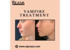 Vampire Treatment in Newport Beach